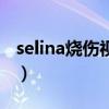 selina烧伤视频（关于selina烧伤视频的介绍）