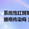 系统性红斑狼疮传染吗?遗传吗?（系统性红斑狼疮传染吗）