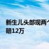 新生儿头部现两个包块，后查出颅骨骨折！家属起诉医院索赔12万