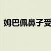 姆巴佩鼻子受伤赛后送医治疗 有望周五复出