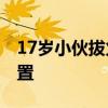 17岁小伙拔火罐被二度烧伤 医生传授如何处置