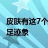 皮肤有这7个变化提示血糖超标了 警惕糖尿病足迹象