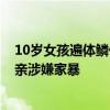 10岁女孩遍体鳞伤 医药费众筹时被质疑遭虐待 当地：其母亲涉嫌家暴