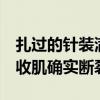 扎过的针装满5升水桶！石智勇独家回应：内收肌确实断裂了