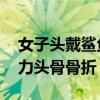 女子头戴鲨鱼夹摔倒后成植物人 后脑着地受力头骨骨折